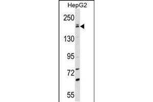 Western blot analysis in HepG2 cell line lysates (35ug/lane). (PNPLA6 Antikörper  (C-Term))