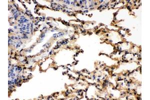 IHC analysis of S100A6 using anti-S100A6 antibody (ABIN3043320). (S100A6 Antikörper  (AA 1-90))