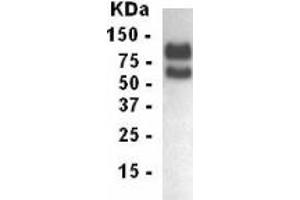 Western Blotting (WB) image for anti-Low Density Lipoprotein Receptor (LDLR) (AA 29-205) antibody (ABIN2467854) (LDLR Antikörper  (AA 29-205))