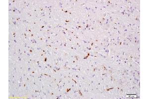 Immunohistochemistry (IHC) image for anti-Vascular Endothelial Growth Factor (VEGF) antibody (ABIN674829)