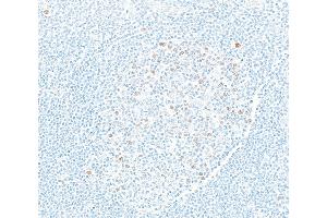 Immunohistochemistry (IHC) image for anti-Enhancer of Zeste Homolog 2 (EZH2) (AA 1-154) antibody (ABIN7795766) (Rekombinanter EZH2 Antikörper  (AA 1-154))