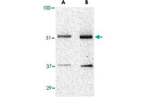 Western blot analysis of TANK in Daudi cell lysate with TANK polyclonal antibody  at (A) 0. (TANK Antikörper  (N-Term))