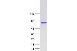 Western Blotting (WB) image for tRNA Methyltransferase 6 Homolog (TRMT6) protein (Myc-DYKDDDDK Tag) (ABIN2734360)