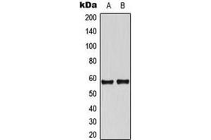 Western blot analysis of Tyrosine Hydroxylase expression in A549 (A), NIH3T3 (B) whole cell lysates. (Tyrosine Hydroxylase Antikörper  (N-Term))