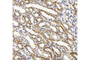 Immunohistochemistry (Paraffin-embedded Sections) (IHC (p)) image for anti-Heat Shock 60kDa Protein 1 (Chaperonin) (HSPD1) antibody (ABIN7074167)