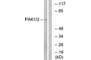 Western blot analysis of extracts from K562 cells, using PAK1/2 (Ab-199) Antibody. (PAK1/2 Antikörper  (AA 165-214))