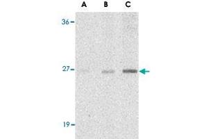 Western blot analysis of C1QTNF7 in NIH/3T3 cell lysate with C1QTNF7 polyclonal antibody  at (A) 1, (B) 2, and (C) 4 ug/mL . (CTRP7 Antikörper  (N-Term))