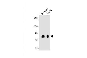 All lanes : Anti- POSTN Antibody (C-term) at 1:1000 dilution Lane 1: human breast lysate Lane 2: rat lung lysate Lysates/proteins at 20 μg per lane. (Periostin Antikörper  (C-Term))