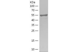 PIP4K2A Protein (AA 208-406) (His-IF2DI Tag)