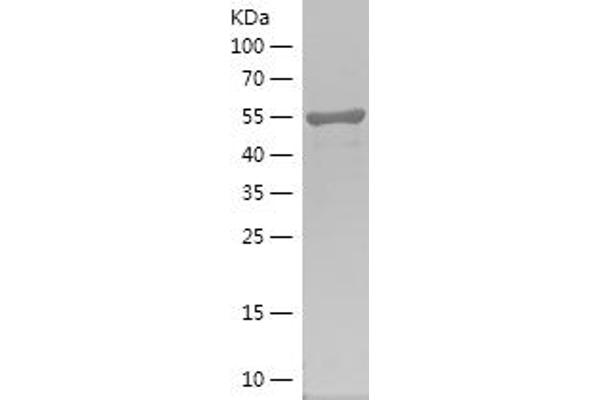 PIP4K2A Protein (AA 208-406) (His-IF2DI Tag)