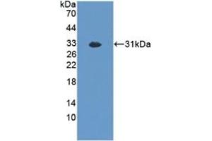 Detection of Recombinant EXO1, Mouse using Polyclonal Antibody to Exonuclease 1 (EXO1) (Exonuclease 1 Antikörper  (AA 1-250))