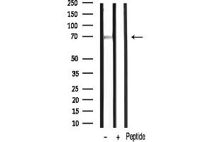 Western blot analysis of PKC zeta phosphorylation expression in mouse liver lysates,The lane on the right was treated with the antigen-specific peptide.
