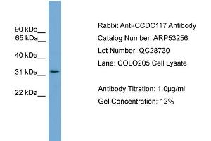WB Suggested Anti-CCDC117  Antibody Titration: 0. (CCDC117 Antikörper  (Middle Region))