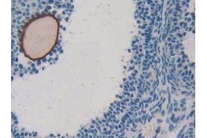 Immunohistochemistry (IHC) image for anti-Activin A Receptor, Type IIB (ACVR2B) (AA 214-350) antibody (ABIN1175515)