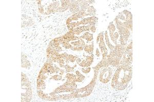 Immunohistochemistry (IHC) image for anti-Metadherin (MTDH) (AA 475-525) antibody (ABIN7795651) (Rekombinanter MTDH Antikörper  (AA 475-525))