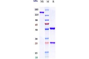 Anti-IL-6 / IFNb2 Reference Antibody (olokizumab) on SDS-PAGE under reducing (R) condition. (Rekombinanter IL6 (Olokizumab Biosimilar) Antikörper)