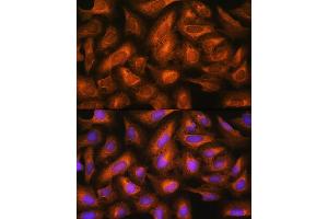 Immunofluorescence analysis of U2OS cells using EIF2B4 Rabbit pAb (ABIN7267037) at dilution of 1:100. (EIF2B4 Antikörper)