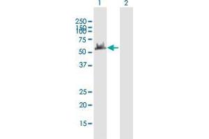 Western Blotting (WB) image for anti-Dynein, Cytoplasmic 1, Light Intermediate Chain 2 (DYNC1LI2) (AA 1-492) antibody (ABIN2566134)