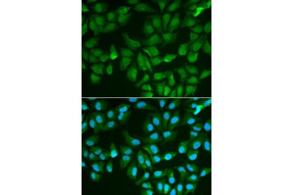 Galectin 3 Antikörper  (AA 1-250)