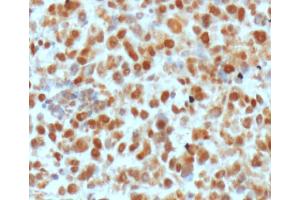 Image no. 3 for anti-DNA Repair Protein Apurinic Endonuclease antibody (ABIN5693483) (DNA Repair Protein Apurinic Endonuclease Antikörper)