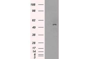 Image no. 4 for anti-Solute Carrier Family 2 (Facilitated Glucose/fructose Transporter), Member 5 (SLC2A5) antibody (ABIN1498477) (SLC2A5 Antikörper)