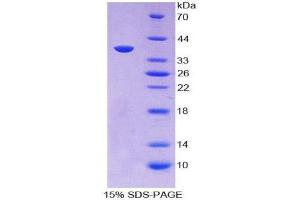 SDS-PAGE (SDS) image for Ligase I, DNA, ATP-Dependent (LIG1) (AA 568-875) protein (His tag) (ABIN2124086) (LIG1 Protein (AA 568-875) (His tag))