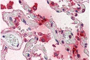 Human Lung (formalin-fixed, paraffin-embedded) stained with TPSAB1 antibody ABIN337204 at 5 ug/ml followed by biotinylated anti-mouse IgG secondary antibody ABIN481714, alkaline phosphatase-streptavidin and chromogen. (TPSAB1 Antikörper)
