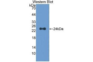 Western Blotting (WB) image for anti-Slit Homolog 2 (Drosophila) (SLIT2) (AA 1160-1333) antibody (ABIN1173398) (SLIT2 Antikörper  (AA 1160-1333))
