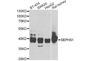 Western blot analysis of extracts of various cell lines, using SEPHS1 antibody (ABIN5973853) at 1/1000 dilution. (SEPHS1 Antikörper)