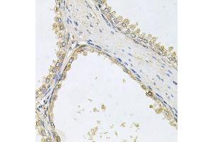 Immunohistochemistry of paraffin-embedded human prostate using POMGNT1 antibody (ABIN6003611) at dilution of 1/100 (40x lens). (POMGNT1 Antikörper)
