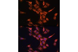 Immunofluorescence analysis of C6 cells using PFDN5 Rabbit pAb (ABIN1681328, ABIN3018415, ABIN3018416 and ABIN6220463) at dilution of 1:100 (40x lens). (PFDN5 Antikörper  (AA 1-154))
