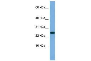 ANKRD39 antibody used at 0. (ANKRD39 Antikörper  (N-Term))