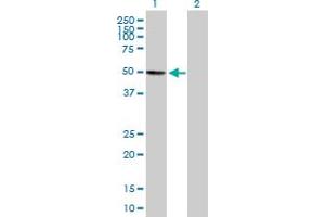 Western Blot analysis of KIAA0141 expression in transfected 293T cell line by KIAA0141 MaxPab polyclonal antibody. (DELE1/KIAA0141 Antikörper  (AA 1-515))