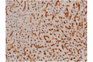 Immunohistochemistry (IHC) image for anti-Ezrin (EZR) (pTyr478) antibody (ABIN6255926)