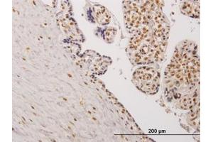 Image no. 1 for anti-Testis-Specific Kinase 2 (TESK2) (AA 405-542) antibody (ABIN599135) (TESK2 Antikörper  (AA 405-542))