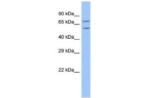 WB Suggested Anti-TRAP1 Antibody Titration: 1. (TRAP1 Antikörper  (N-Term))
