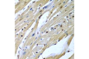 Immunohistochemistry of paraffin-embedded mouse heart using TUSC2 antibody (ABIN5974256) at dilution of 1/200 (40x lens). (TUSC2 Antikörper)