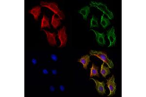 ABIN6264457 and ABIN6272976 staining Hela cells by IF/ICC. (PSAT1 Antikörper  (Internal Region))