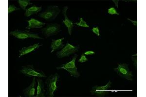 Immunofluorescence of monoclonal antibody to VCL on HeLa cell. (Vinculin Antikörper  (AA 1-1066))