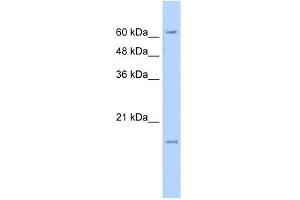 WB Suggested Anti-SLC13A3 Antibody Titration:  5. (SLC13A3 Antikörper  (N-Term))