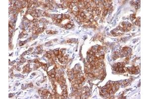 Image no. 2 for anti-Keratin 18 (KRT18) antibody (ABIN3026949) (Cytokeratin 18 Antikörper)