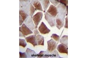 Immunohistochemistry (Paraffin-embedded Sections) (IHC (p)) image for anti-Eukaryotic Translation Initiation Factor 2B, Subunit 4 Delta, 67kDa (EIF2B4) (AA 153-183), (Middle Region) antibody (ABIN952044)