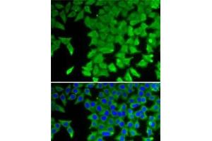 Immunofluorescence analysis of U2OS cells using CRABP2 Polyclonal Antibody (CRABP2 Antikörper)