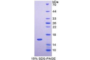 SDS-PAGE analysis of Human TMEM27 Protein. (TMEM27 Protein)