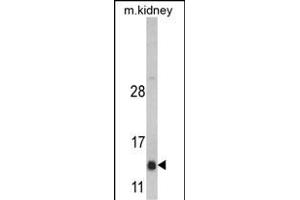 Western Blotting (WB) image for anti-DnaJ (Hsp40) Homolog, Subfamily C, Member 19 (DNAJC19) (AA 55-84) antibody (ABIN390453)