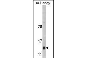 Western blot analysis of DNAJC19 Antibody (Center) (ABIN390453 and ABIN2840826) in mouse kidney tissue lysates (35 μg/lane). (DNAJC19 Antikörper  (AA 55-84))