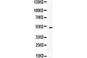 Western blot analysis of FCGRT expression in A549 whole cell lysates (lane 1).