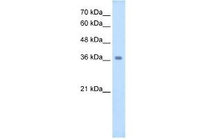 Western Blotting (WB) image for anti-Wingless-Type MMTV Integration Site Family, Member 16 (WNT16) (C-Term) antibody (ABIN2776717)