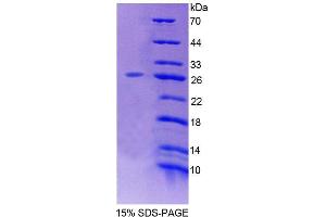 SDS-PAGE analysis of Mouse LRP1B Protein. (LRP1B Protein)