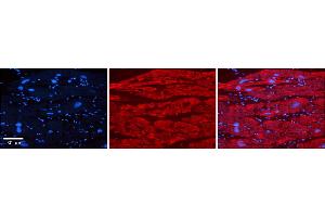 Rabbit Anti-TRIM10 Antibody    Formalin Fixed Paraffin Embedded Tissue: Human Adult heart  Observed Staining: Cytoplasmic Primary Antibody Concentration: 1:600 Secondary Antibody: Donkey anti-Rabbit-Cy2/3 Secondary Antibody Concentration: 1:200 Magnification: 20X Exposure Time: 0. (TRIM10 Antikörper  (Middle Region))